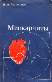 Миокардиты