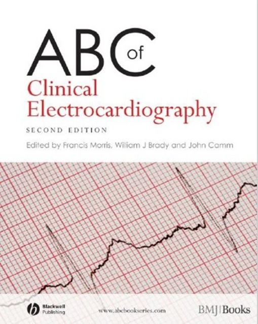 ABC of clinical electrocardiography.