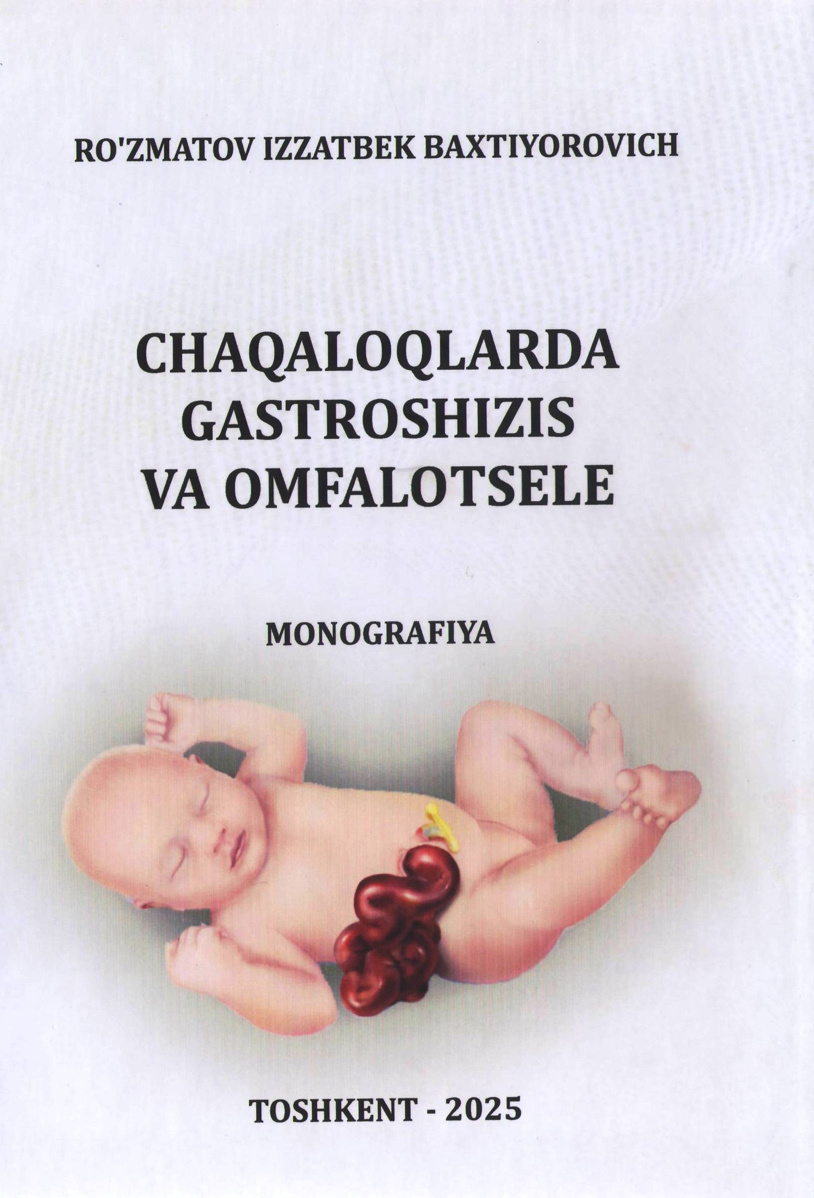 Chaqaloqlarda gastroshizis va omfalotsele