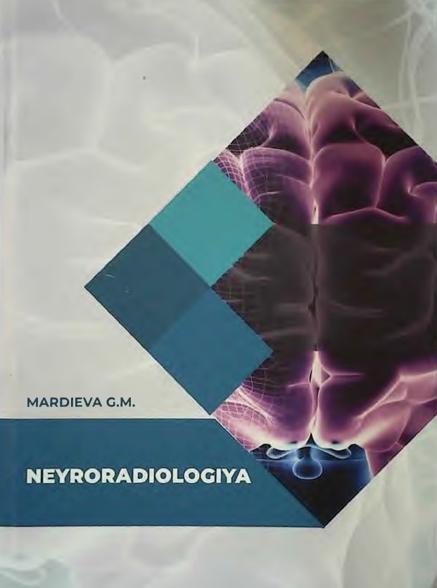 Neyroradiologiya